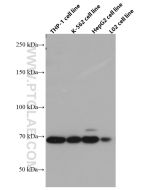 TGFBR2 Monoclonal antibody proteintech 66636-1-Ig
