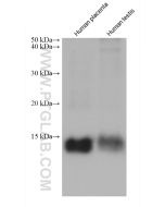 MGP Monoclonal antibody proteintech 60055-1-Ig