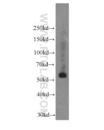 Fibrinogen Gamma Chain Monoclonal antibody proteintech 66158-1-Ig