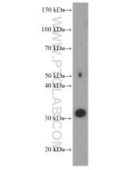 SRD5A1 Monoclonal antibody proteintech 66329-1-Ig