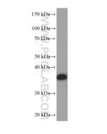 PHOX2B Monoclonal antibody proteintech 66254-1-Ig