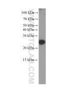 C-Reactive Protein/CRP Monoclonal antibody proteintech 66250-1-Ig