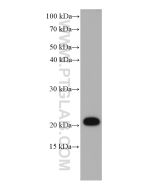 STMN2 Monoclonal antibody proteintech 67204-1-Ig