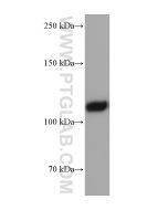 EMCN Monoclonal antibody proteintech 67854-1-Ig