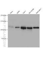 USP4 Monoclonal antibody proteintech 66822-1-Ig