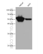 MICA Monoclonal antibody proteintech 66384-1-Ig