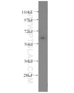 Fibromodulin Monoclonal antibody proteintech 60108-1-Ig