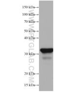 Annexin A10 Monoclonal antibody proteintech 66869-1-Ig