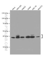 ERK1/2 Monoclonal antibody proteintech 66192-1-Ig