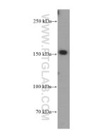 TEM1 Monoclonal antibody proteintech 60170-1-Ig