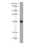 SARS-CoV-2 S protein (RBD, 319-541 aa) Monoclonal antibody proteintech 67758-1-Ig