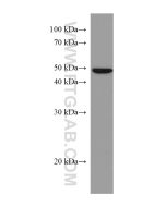 Caspase 4 Monoclonal antibody proteintech 67398-1-Ig