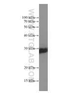 KCNIP4 Monoclonal antibody proteintech 60133-1-Ig