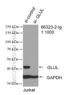 Glutamine Synthetase Monoclonal antibody proteintech 66323-2-Ig