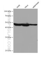 P2RX4 Monoclonal antibody proteintech 66416-1-Ig