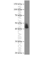 ASS1 Monoclonal antibody proteintech 66036-1-Ig