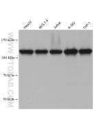 ESYT1 Monoclonal antibody proteintech 67688-1-Ig