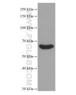 TGFBI / BIGH3 Monoclonal antibody proteintech 60007-1-Ig