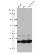 GNAI2 Monoclonal antibody proteintech 67007-1-Ig