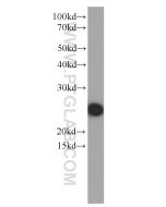 Apolipoprotein AI Monoclonal antibody proteintech 66206-1-Ig