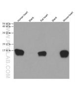 FABP3 Monoclonal antibody proteintech 60280-1-Ig