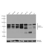 CNOT4 Monoclonal antibody proteintech 67798-1-Ig