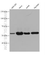 ATG13 Monoclonal antibody proteintech 66708-1-Ig