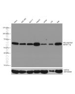 P62/SQSTM1 Monoclonal antibody proteintech 66184-1-Ig