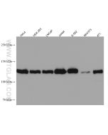 USP8 Monoclonal antibody proteintech 67321-1-Ig