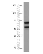 KGA/GAC Monoclonal antibody proteintech 66265-1-Ig
