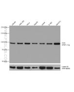 FER Monoclonal antibody proteintech 67671-1-Ig