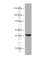 AMT Monoclonal antibody proteintech 67532-1-Ig