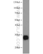 Serum amyloid P component Monoclonal antibody proteintech 66084-1-Ig