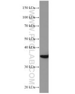 DMC1 Monoclonal antibody proteintech 67176-1-Ig