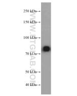 human IgM Monoclonal antibody proteintech 66484-1-Ig