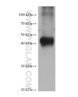 GATM Monoclonal antibody proteintech 68513-1-Ig
