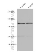 Factor XIIIa Monoclonal antibody proteintech 66325-1-Ig