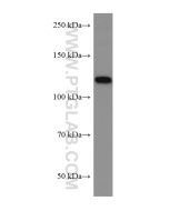 ACLY Monoclonal antibody proteintech 67166-1-Ig