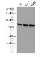 SLC6A12 Monoclonal antibody proteintech 67700-1-Ig