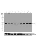 Cytohesin 2 Monoclonal antibody proteintech 67185-1-Ig