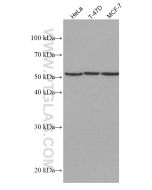 CYP1B1 Monoclonal antibody proteintech 67033-1-Ig