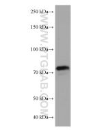 KEAP1 Monoclonal antibody proteintech 60027-1-Ig