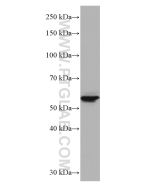 GLUT2 Monoclonal antibody proteintech 66889-1-Ig
