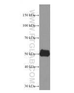 AGTR1 Monoclonal antibody proteintech 66415-1-Ig