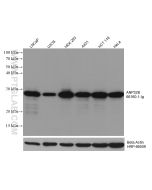ANP32B Monoclonal antibody proteintech 66160-1-Ig