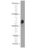 Integrin Beta 1/CD29 Monoclonal antibody proteintech 66315-1-Ig