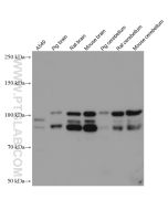 PDE4D Monoclonal antibody proteintech 67062-1-Ig
