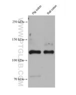 Collagen Type III Monoclonal antibody proteintech 68320-1-Ig