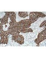 HER2/ErbB2 Monoclonal antibody proteintech 60311-1-Ig