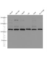 FGFR3 Monoclonal antibody proteintech 66954-1-Ig